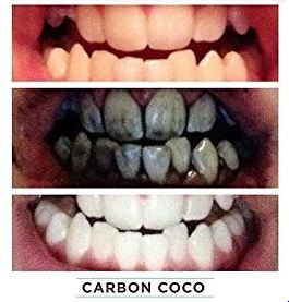 Carbon Coco Erfahrungen Testbericht Testberichte